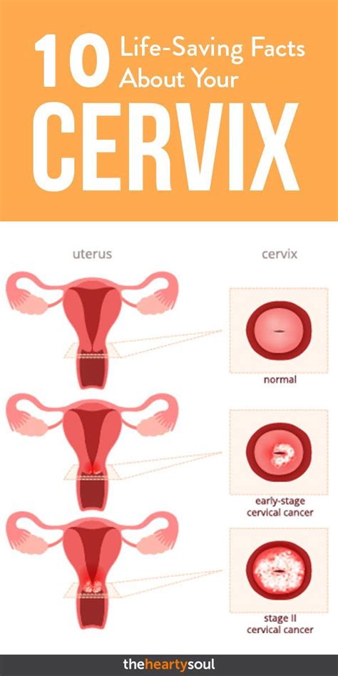 Cervix Has No Pain Receptors Reproduction Online