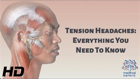 Tension Headaches Everything You Need To Know YouTube