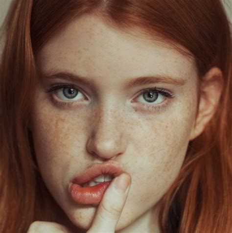 19 Reasons To Embrace Your Freckles And Rock Them With Pride Ginger