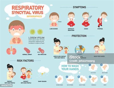 Rsv Respiratory Syncytial Virus Infografik Stock Vektor Art Und Mehr