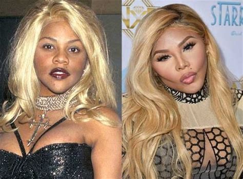 Old School Rapper Lil Kims Plastic Surgeries Before And After