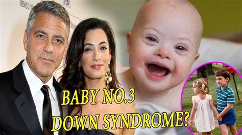George Clooneys Twins Navigate Life With Down Syndrome