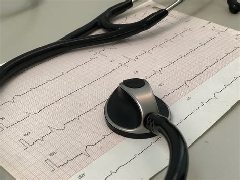 Interpretación básica del electrocardiograma Escuela Ciencias de la Salud
