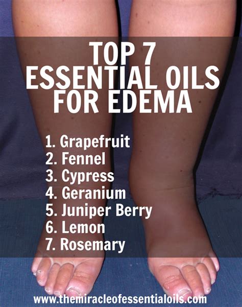 7 Essential Oils For Edema Plus 3 Recipes To Use The Miracle Of