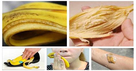 7 Uses Of Banana Peels Gonutripro