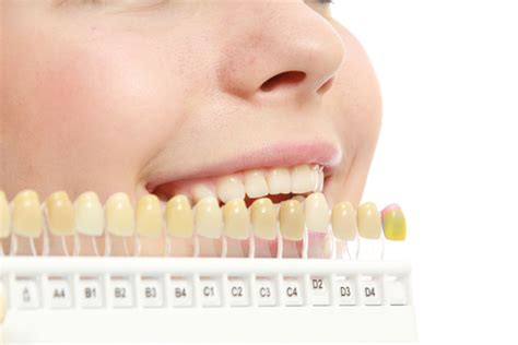 Why Your Teeth Changed Colors Over The Years Ventura Total Dentistry