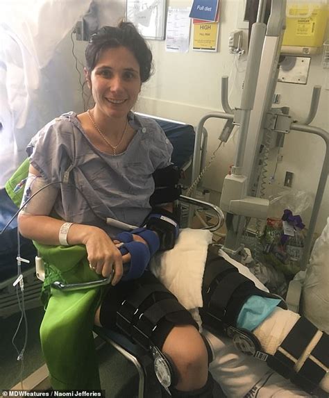 Woman Has Leg Amputated After Seventeen Failed Surgeries