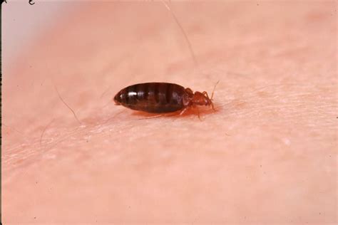 Scabies Vs Bed Bugs What Are The Differences Pestseek