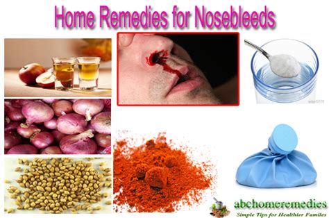 12 Overlooked Home Remedies For Nosebleeds