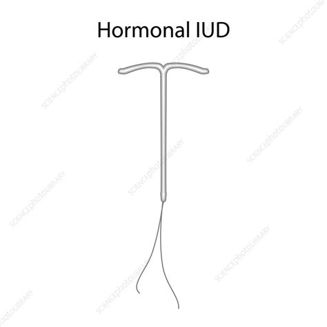 Hormonal Intrauterine Devices Illustration Stock Image F0341830