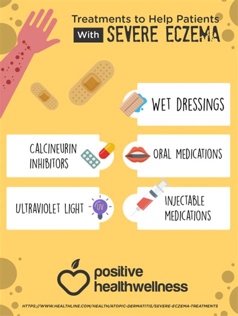 5 Treatments To Help Patients With Severe Eczema Infographic