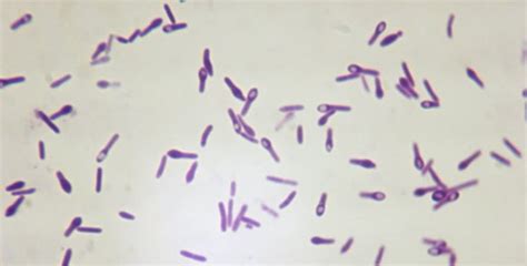 Clostridium tetani, tetanus (frank geisler) clostridium tetani, tetanus (steffen jähde) klicke hier, um einen neuen artikel im doccheck flexikon anzulegen. Clostridium tetani - Zdravlje