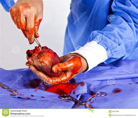 Surgeon Busy With Heart Operation Stock Photo Image Of Life Delicate