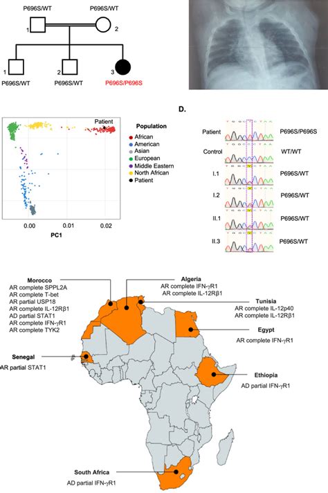 Autosomal Recessive Partial Stat Deficiency In Senegal A Stat Download Scientific Diagram
