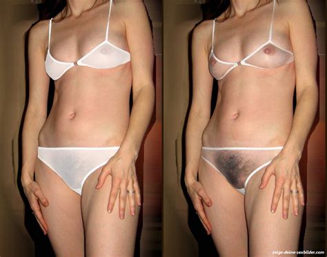 R Ntgen Nacktbilder Aus Meinem Labor Zeige Deine Sex Bilder