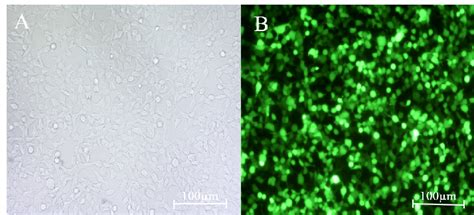 5 the use of human cells for research and development is not an issue for most people. Transduction of HEK-293T cells by lentiviral particles. A ...