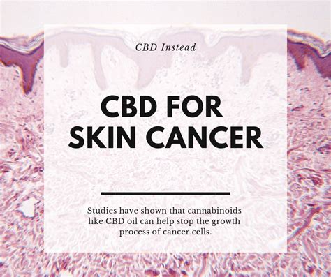 Symptoms Of Skin Cancer Cbd Instead