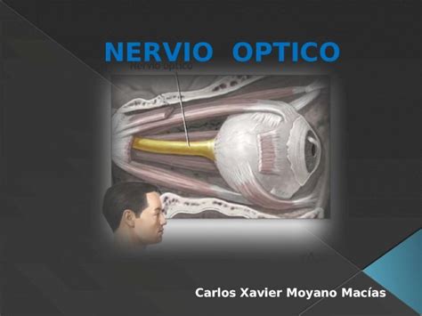 Pptx Nervio Optico Dokumen Tips Hot Sex Picture