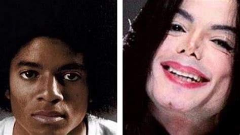 La Obsesión De Michael Jackson Por Su Nariz Que Le Llevó A Realizarse