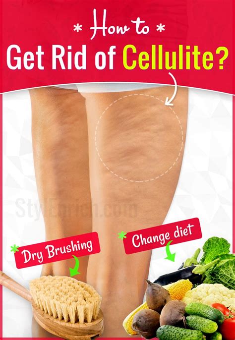 How To Get Rid Of Cellulite From Thighs Buttocks Hips And Lower Stomach