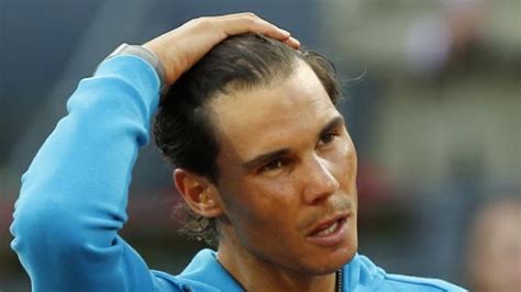 Rafael Nadal Is Ready For A Second Hair Transplant Biothik