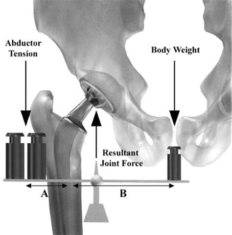 Hip Biomechanics Recon Orthobullets