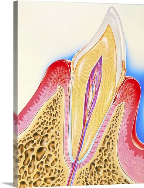 Artwork Of Tooth Showing Periodontal Disease Wall Art Prints Canvas