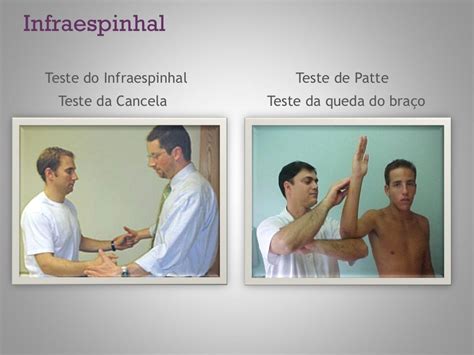 Dor Em Membros Superiores Cid