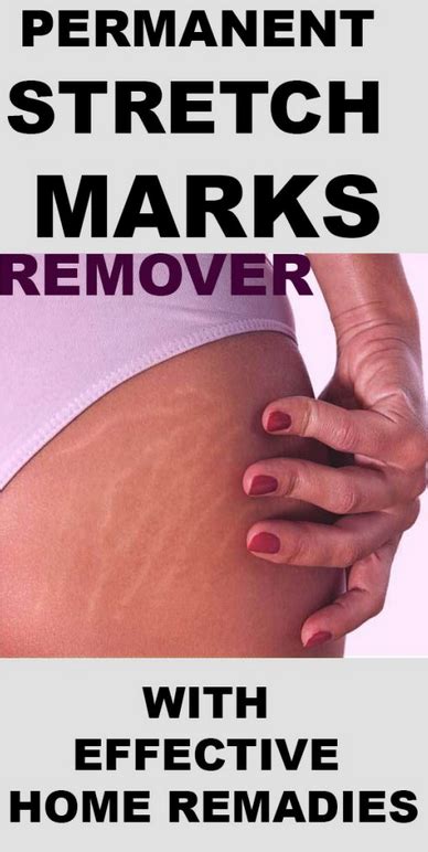 Pin On Stretch Marks Removers