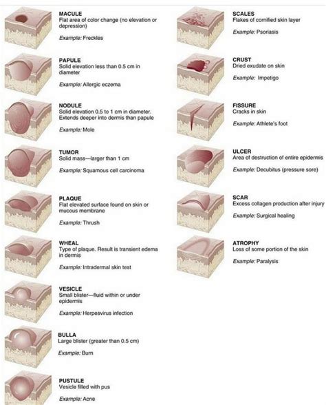 Skin Lesions Guide Rcoolguides