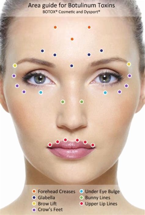 Botox Injection Sites Face Diagram Diagram For You