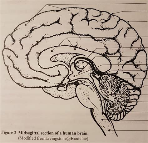 Midsagittal Section Of A Human Brain Diagram Quizlet