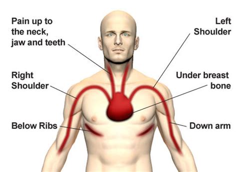 The chest workout for huge, defined pecs. Cardiac Emergencies: Assessment, Angina, & MI | Nursing ...