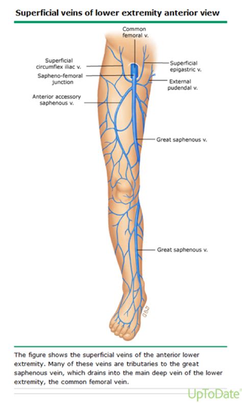 Red Hot Legs Thrombophlebitis Of The Superficial Veins Of The Lower Extremity — Brown