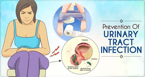Urinary Tract Infection Signs Causes And How You Can Prevent Them