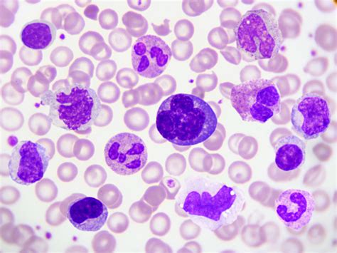 White Blood Cells Stock Photo - Download Image Now - iStock
