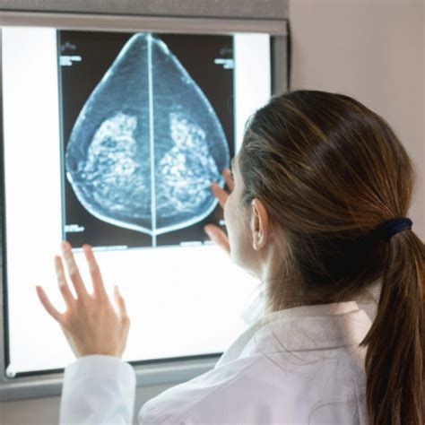 Deep Learning Model As Accurate As Radiologists In Identifying Breast Density Health Data