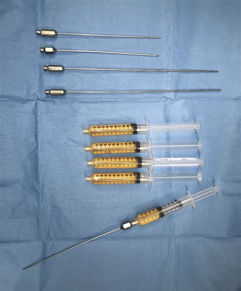 6 Fat Grafting For Primary Augmentation Plastic Surgery Key