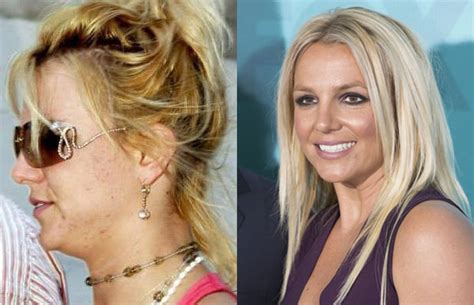 Photos Of Celebrities Without Makeup Britney Spears Without Makeup Viralscape