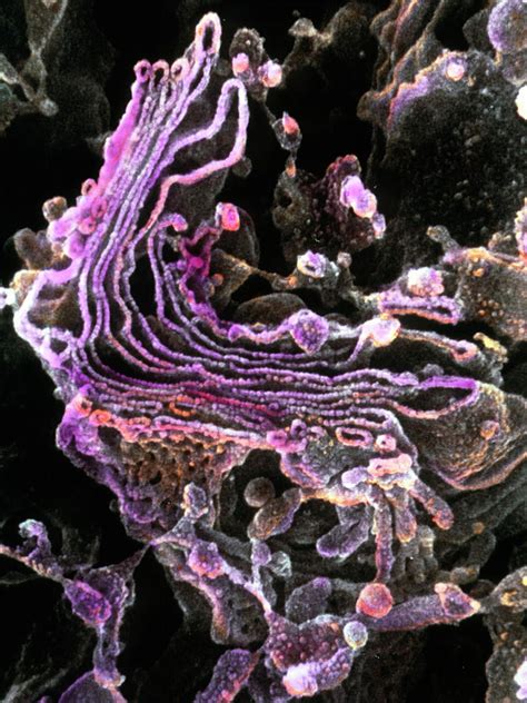 Golgi Complex In Olfactory Bulb Cell Photograph By Professors P Motta