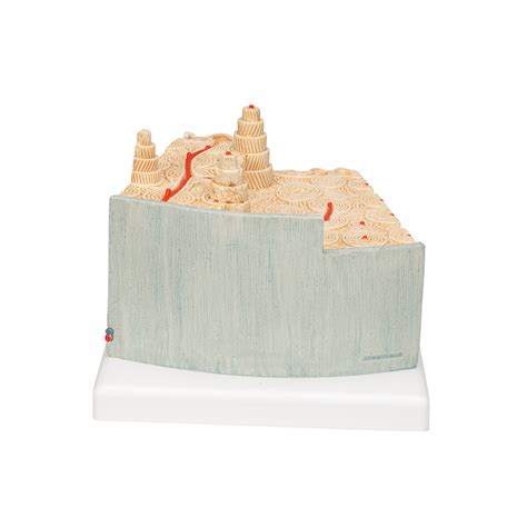 A79 | 3B MICROanatomy™ Bone structure - 80 times enlarged | 3B Scientific