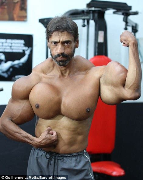 Brazilian Man Injected Himself With Oil To Become A Beefcake With 23