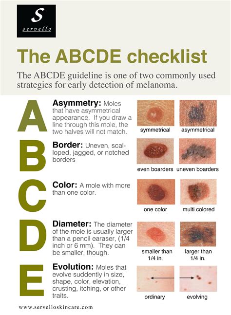 The Abcdes Of Skin Cancer Bu