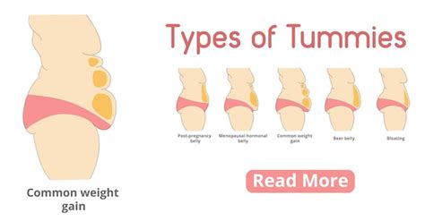 여성 Tummies 배너의 종류 배 턱 수술 또는 복부 성형술 임신 후 갱년기 호르몬 배 맥주 배 복부 팽만감