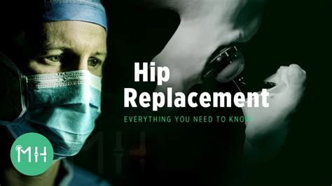 Hip Replacement Everything You Need To Know Youtube