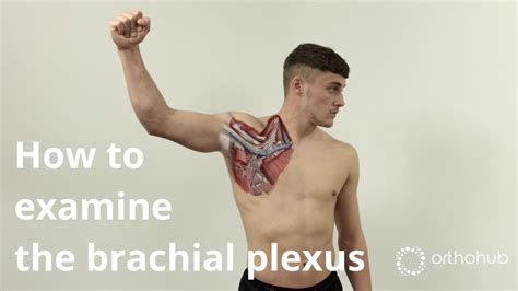 How To Examine The Brachial Plexus Short Version — Watch Orthohub