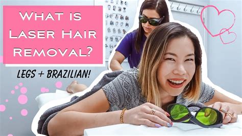 My Laser Hair Removal Experience Legs Brazilian Youtube