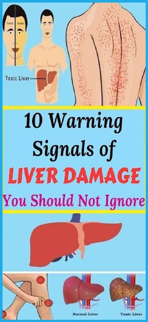 10 Warning Signals Of Liver Damage You Should Not Ignore In 2020