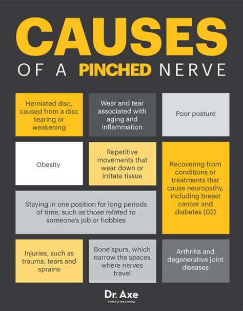 The 25 Best Pinched Nerve In Neck Ideas On Pinterest Nerve Damage In
