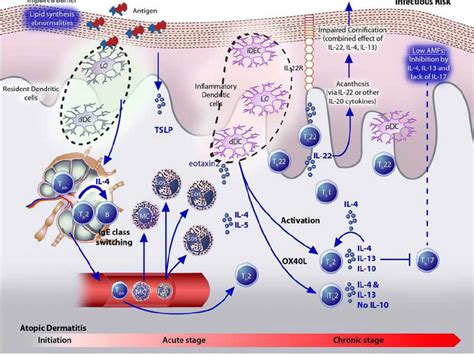 Atopic Dermatitis Pathogenesis